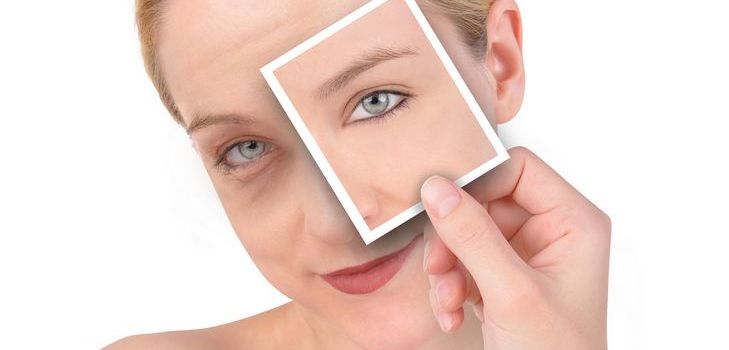Livrar-se de um hematoma em um dia com dicas simples
