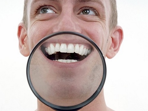 Como lidar com manchas brancas nos dentes