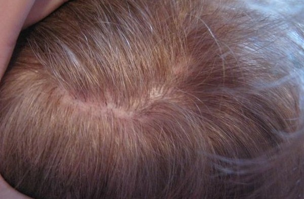 Coloração de cabelo Garnier - revisão de fotos e vídeos Coloração de cabelo Garnier - revisão de fotos e vídeos