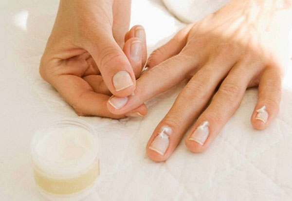 Cinco problemas frequentes nas unhas: causas e soluções