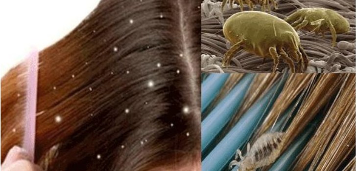 lice close-up