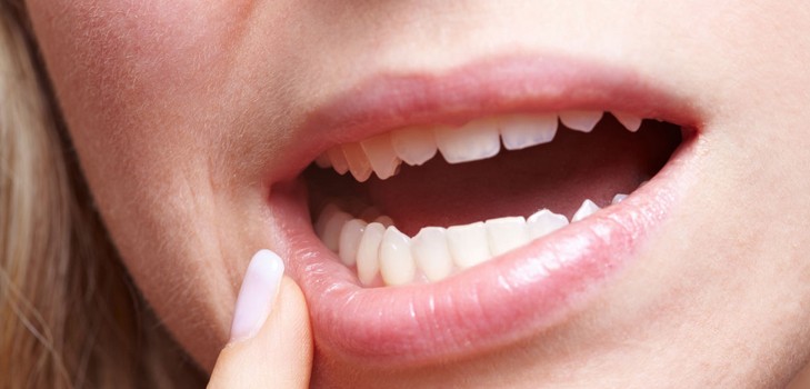 Por que coça os dentes em um adulto