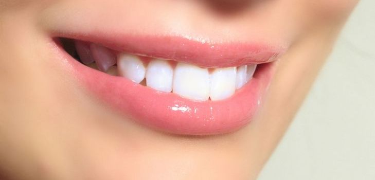 A implantação dentária é um luxo ou uma necessidade? 