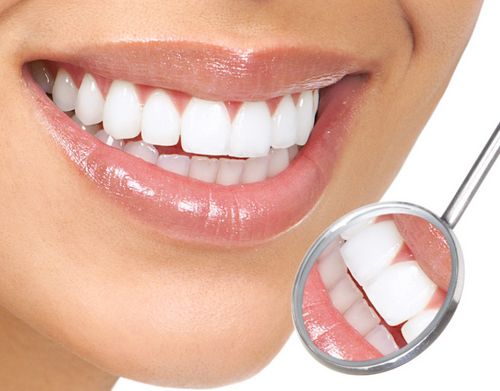 A implantação dentária é um luxo ou uma necessidade? 