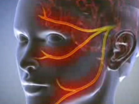 Neuralgia: sintomas, fotos, tratamento