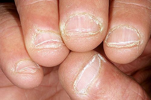 Como reconhecer e o que fazer em caso de distúrbios metabólicos