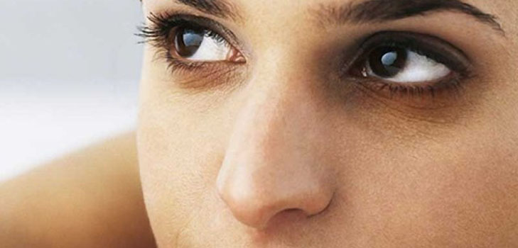 Remédio para contusões sob os olhos